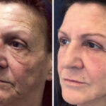 siperstein-makeover1