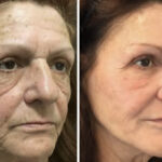 siperstien-makeover3