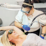 sipderm-ASER-HAIR-REMOVAL
